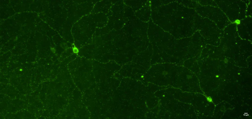 Anti-mOPN4 (Melanopsin) Antibody