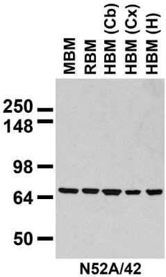 Anti-Mortalin/GRP75 Antibody