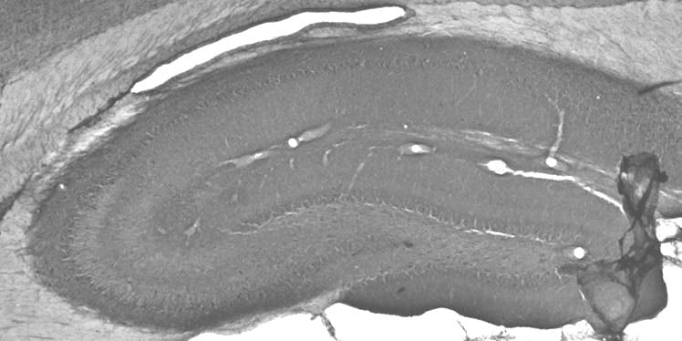Anti-Mortalin/GRP75 Antibody - Image 2