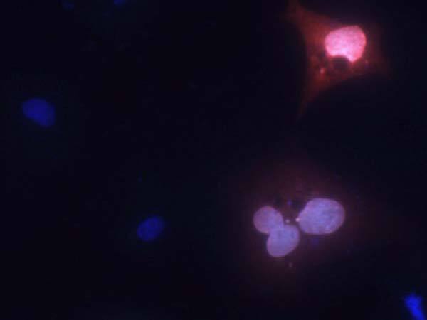 Anti-MPP8 Antibody - Image 2