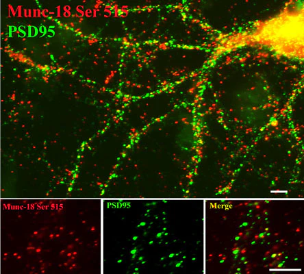 Anti-Munc-18 (Ser 513) Antibody - Image 2