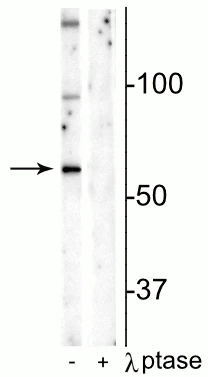 Anti-Munc18-1 (Ser241) Antibody