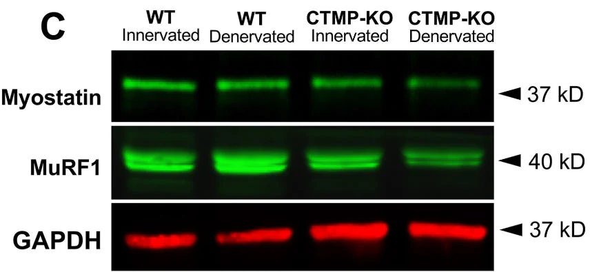 Anti-MuRF1 (C-terminal region) Antibody - Image 6