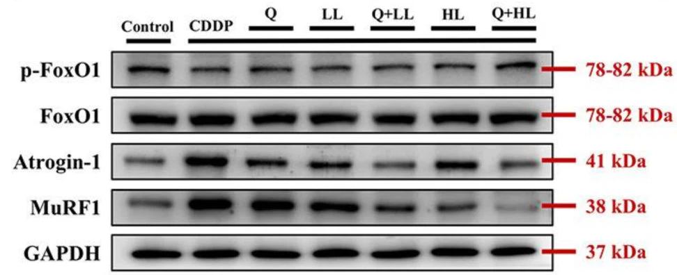 Anti-MuRF1 (C-terminal region) Antibody - Image 7