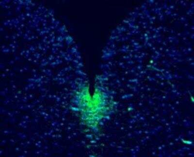 Anti-Musashi 1 Antibody