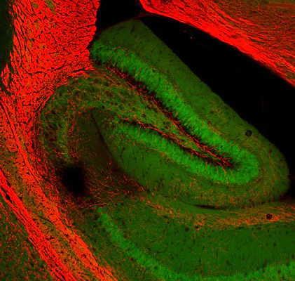 Anti-Myelin Basic Protein (MBP) Antibody