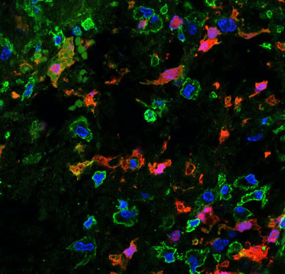 Anti-Myelin Basic Protein (MBP) Antibody - Image 5