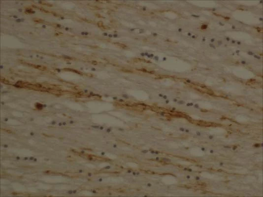 Anti-Myelin basic protein, degraded (dMBP) Antibody