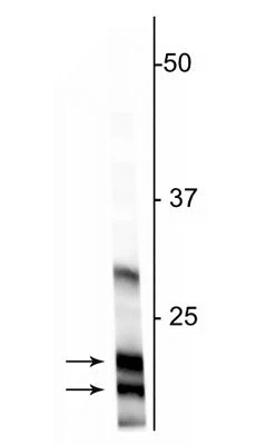 Anti-Myelin Basic Protein (MBP) Antibody - Image 2