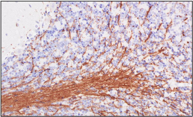 Anti-Myelin Basic Protein (MBP) Antibody