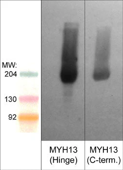 Anti-Myosin 13/Extraocular Myosin (C-terminal region) Antibody