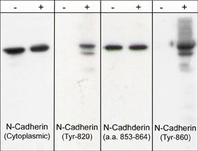 Anti-N-Cadherin (Y860) [E-Cadherin (Y835)], Phosphospecific Antibody