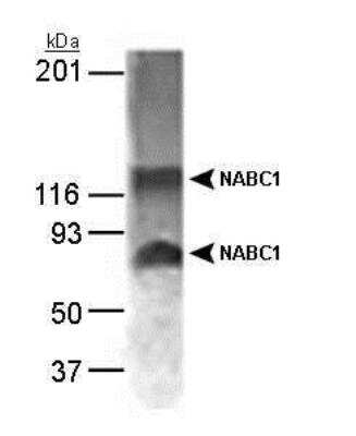 Anti-NABC1 Antibody