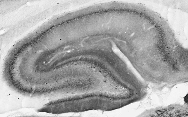 Anti-Nav1.1 Na+ Channel Antibody