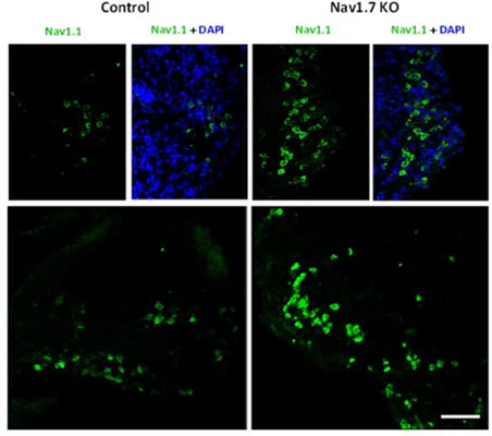 Anti-Nav1.1 Na+ Channel Antibody - Image 2