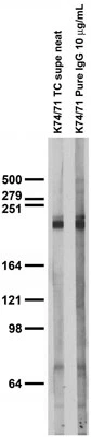 Anti-Nav1.1 Na+ Channel Antibody - Image 3