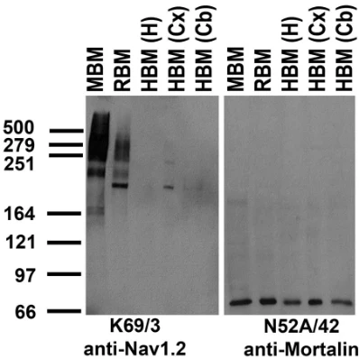Anti-Nav1.2 Na+ Channel Antibody - Image 2