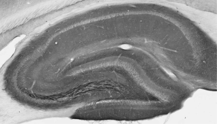 Anti-Nav1.2 Na+ Channel Antibody - Image 4