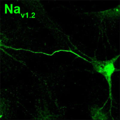 Anti-Nav1.2 Na+ Channel Antibody - Image 5