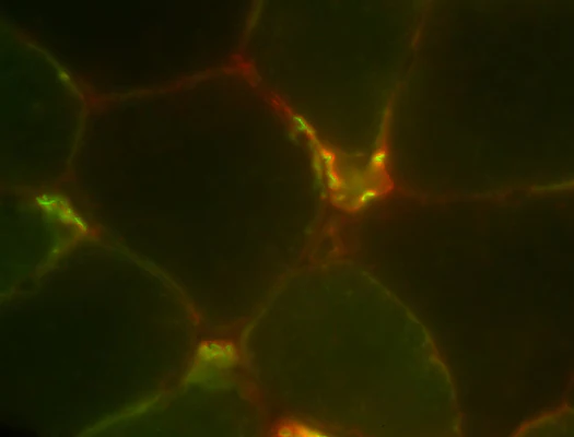 Anti-Nav1.4 Sodium Channel Antibody