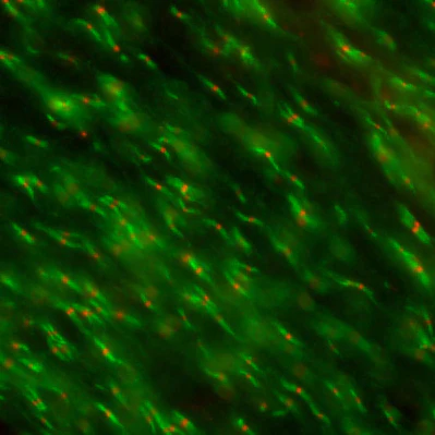 Anti-Nav1.6 Na+ Channel Antibody