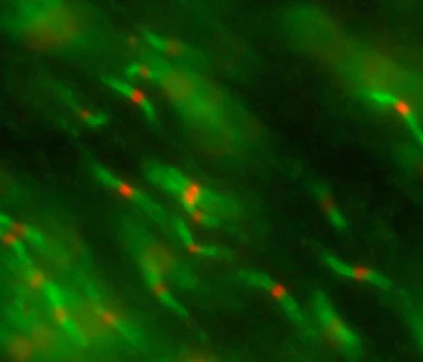Anti-Nav1.6 Na+ Channel Antibody - Image 2