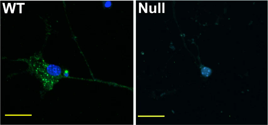 Anti-Nav1.6 Na+ Channel Antibody - Image 3