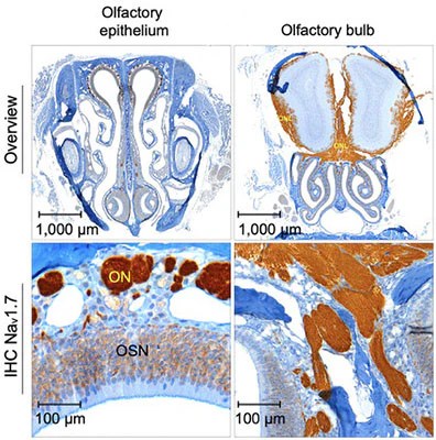 Anti-Nav1.7 Na+ Channel Antibody - Image 2