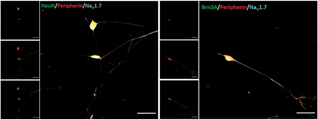 Anti-Nav1.7 Na+ Channel Antibody - Image 3