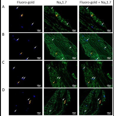 Anti-Nav1.7 Na+ Channel Antibody - Image 4