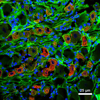 Anti-Nav1.8 Na+ Channel Antibody