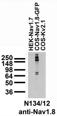 Anti-Nav1.8 Na+ Channel Antibody - Image 2