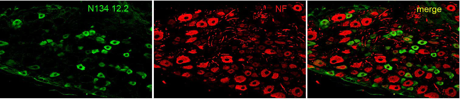 Anti-Nav1.8 Na+ Channel Antibody - Image 4