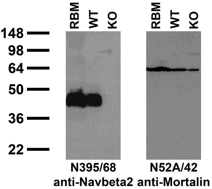 Anti-Navbeta2 Na+ Channel Antibody - Image 2