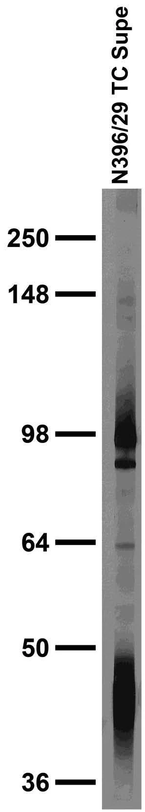 Anti-Navbeta3 Na+ Channel Antibody - Image 2