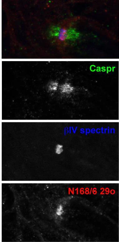 Anti-Navbeta4 Na+ Channel Antibody