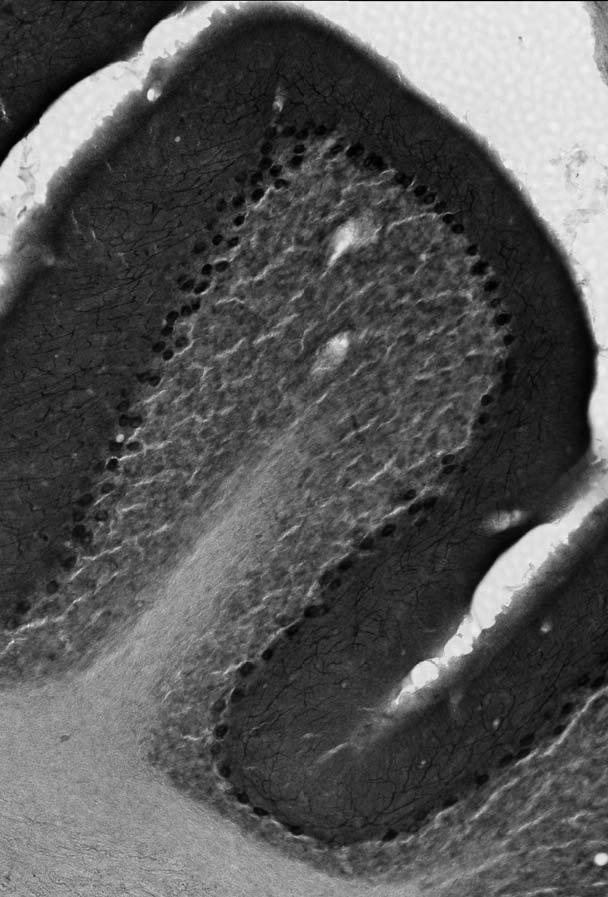 Anti-Navbeta4 Na+ Channel Antibody - Image 3