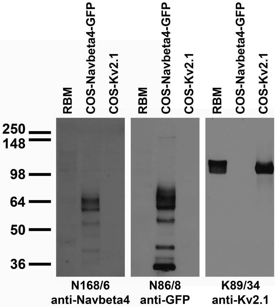 Anti-Navbeta4 Na+ Channel Antibody - Image 4
