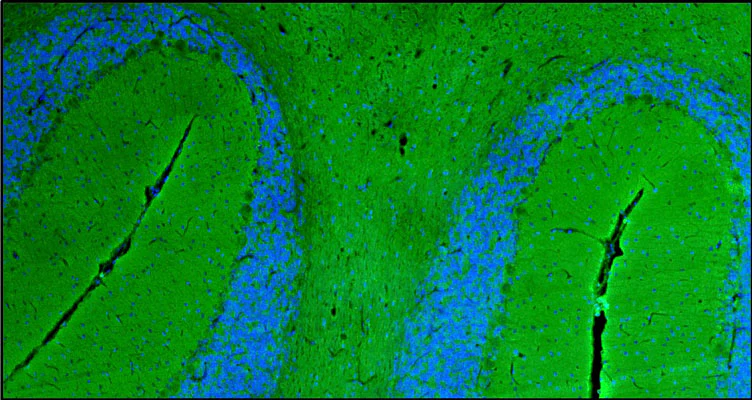 Anti-NCAM1 Antibody