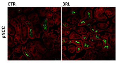 Anti-NCC (Thiazide sensitive NaCl cotransporter) (Thr53) Antibody - Image 4