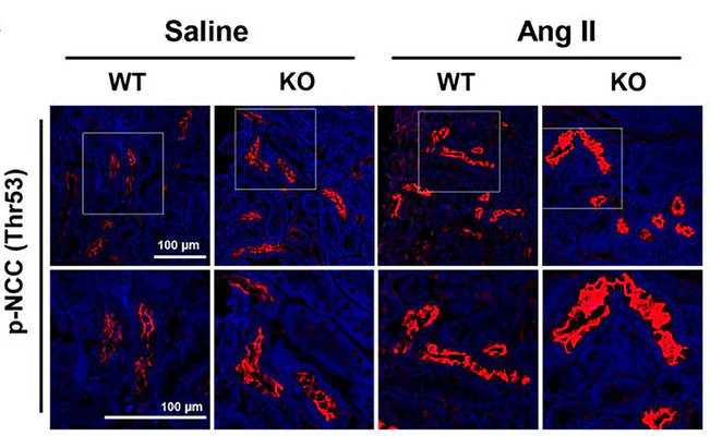 Anti-NCC (Thiazide sensitive NaCl cotransporter) (Thr53) Antibody - Image 5