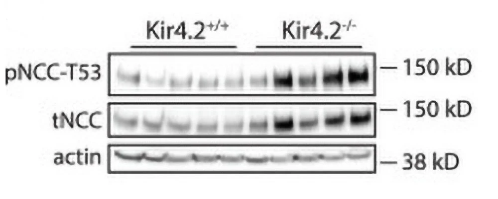 Anti-NCC (Thiazide sensitive NaCl cotransporter) (Thr53) Antibody - Image 6