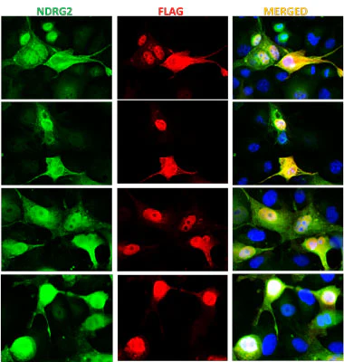 Anti-NDRG2 Antibody
