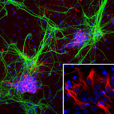 Anti-Nestin Antibody - Image 2