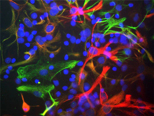 Anti-Nestin Antibody - Image 3