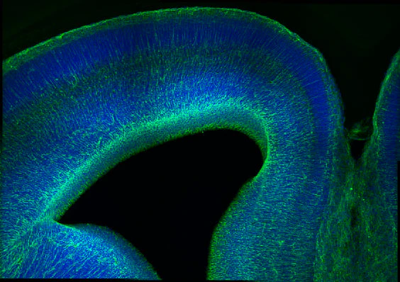Anti-Nestin Antibody - Image 4