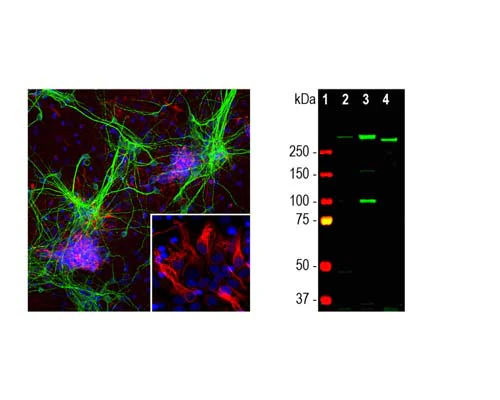 Anti-Nestin Antibody - Image 2