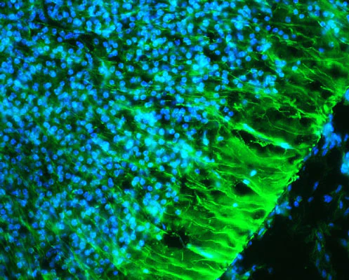 Anti-Nestin Antibody - Image 5