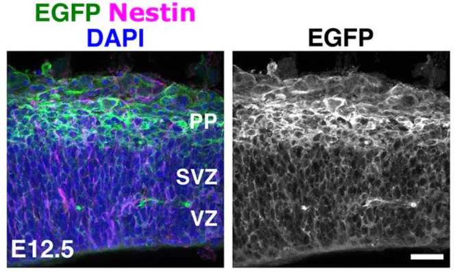 Anti-Nestin Antibody - Image 7