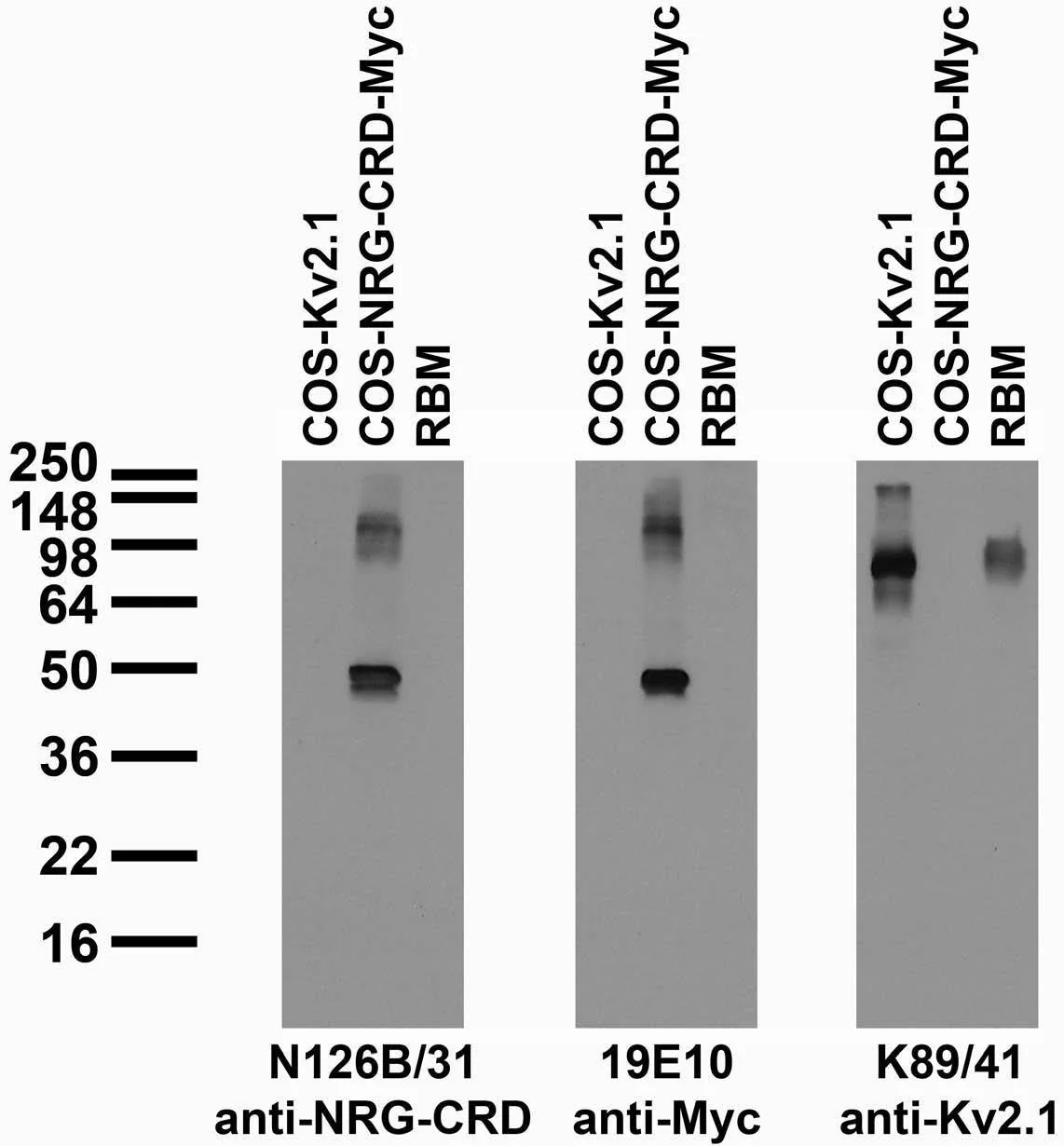 Anti-Neuregulin-CRD (Cysteine-Rich Domain, Type III) Antibody